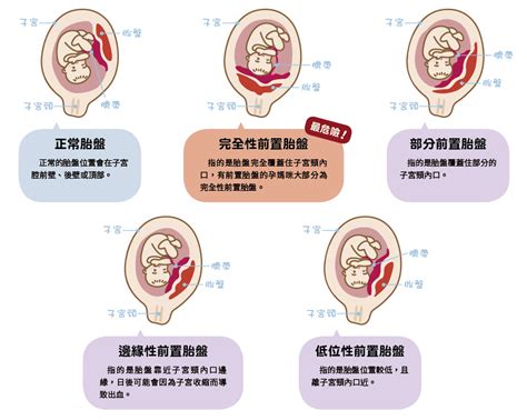 胎盤長怎樣